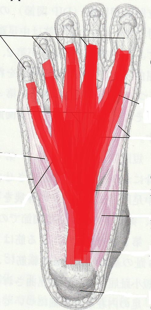 足裏のネット　足底腱膜